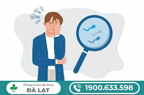 Hình ảnh minh họa